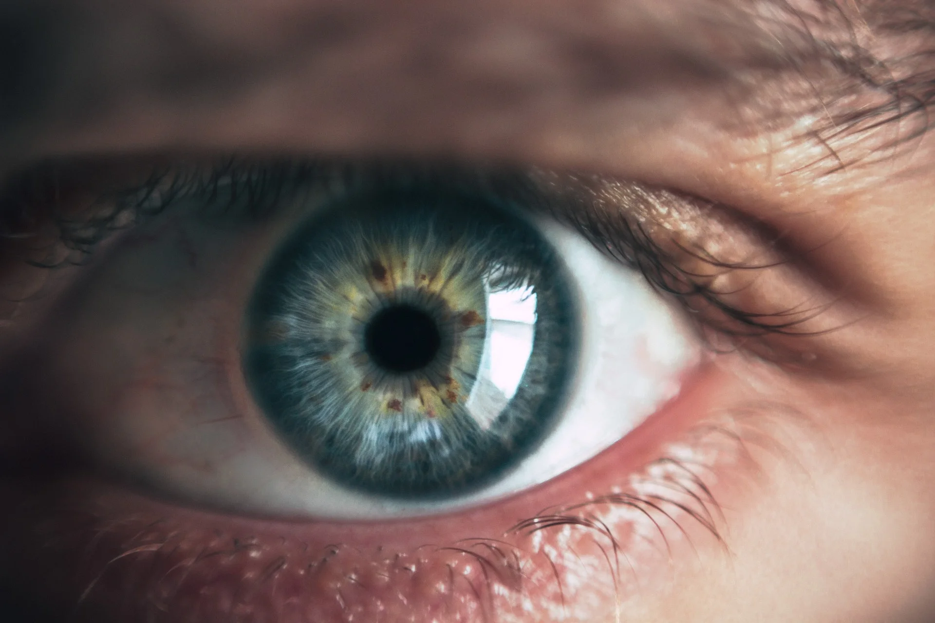 Case of the month: Sudden loss of vision in a young male lessons learnt ;  a true clinical story