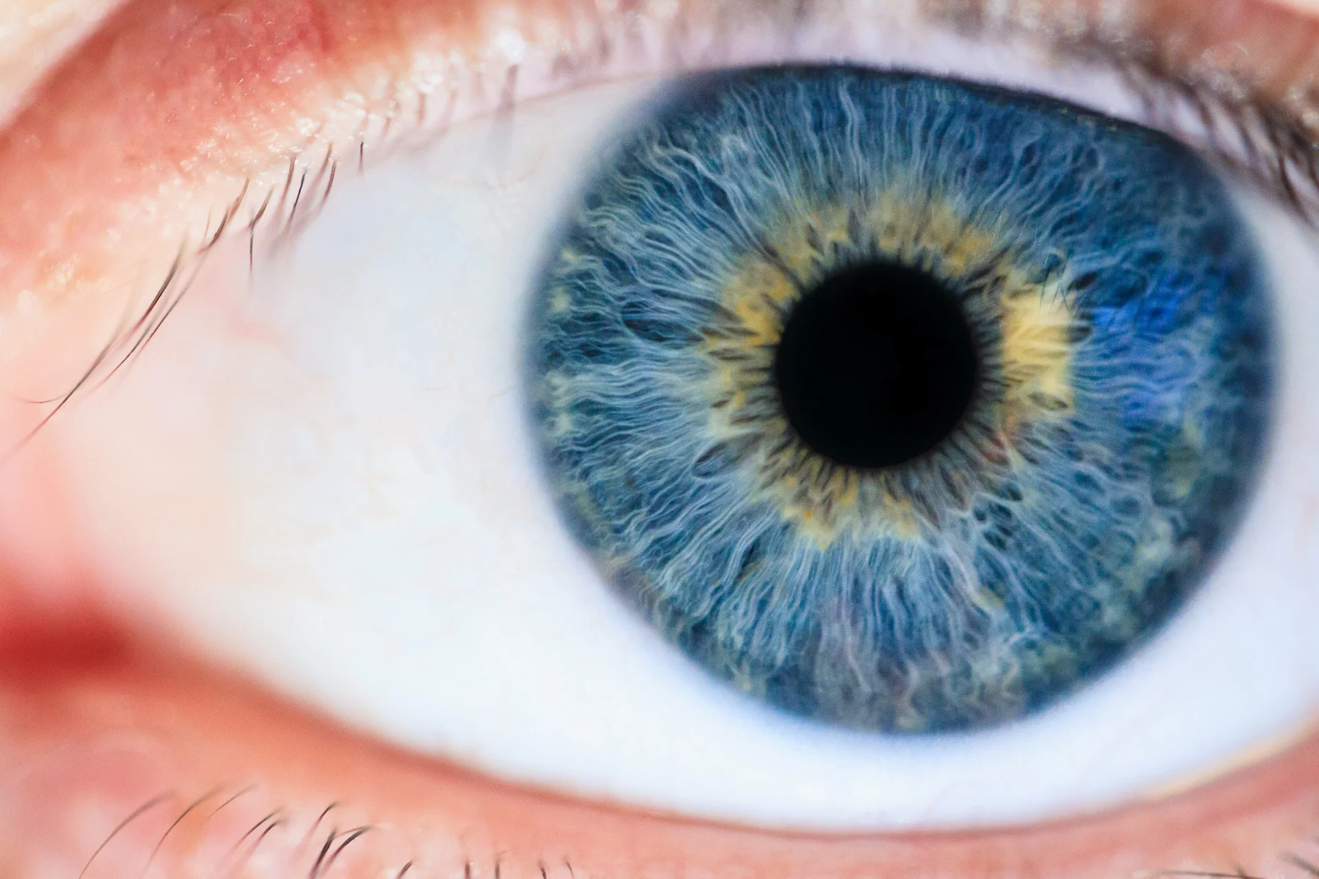 Dialysis  improved his vision !
