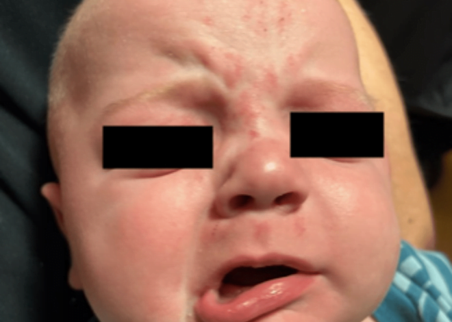 Case of the month: Facial deviation in a child