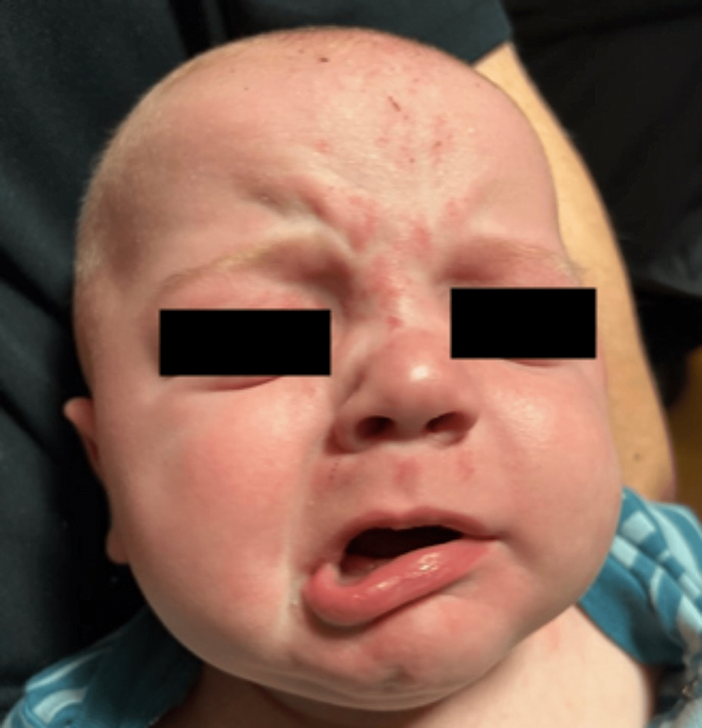 Case of the month: Facial deviation in a child