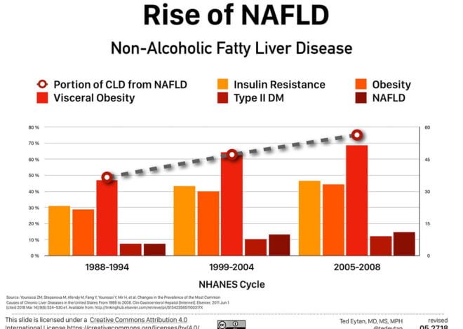 Editorial: Fatty Liver