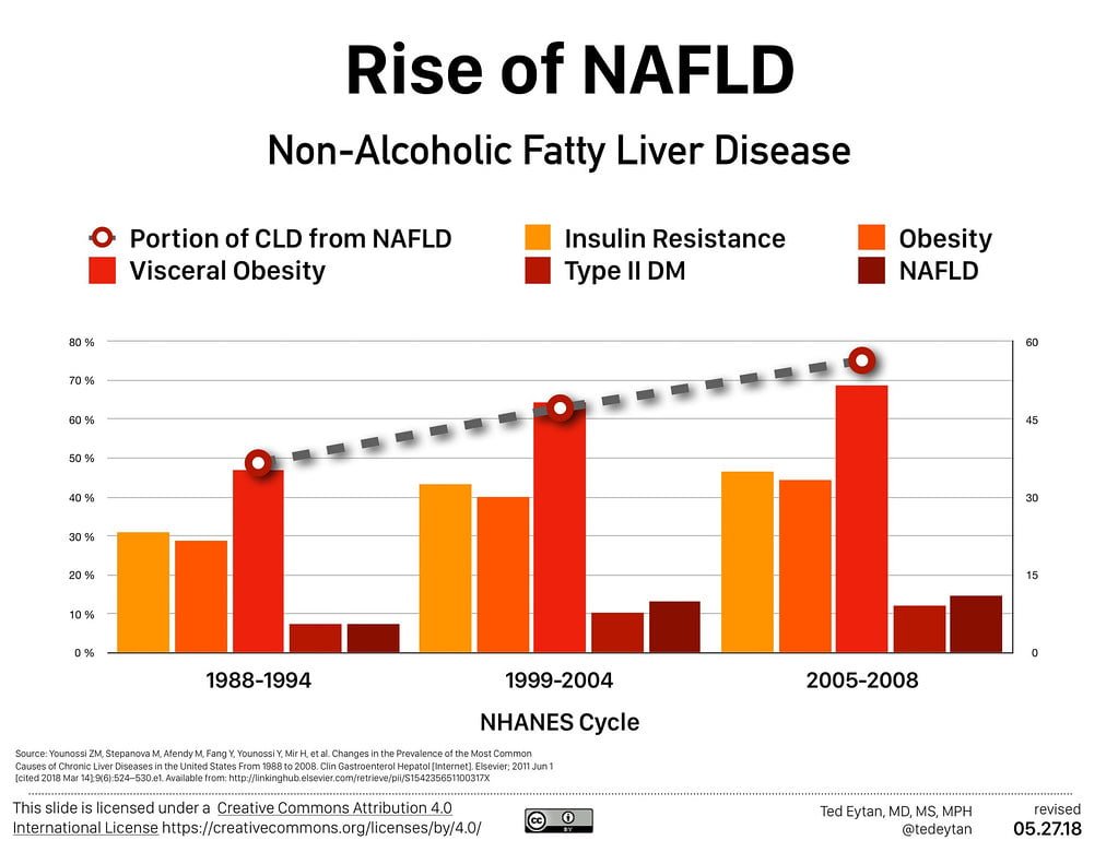 Editorial: Fatty Liver